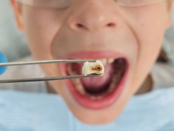 Best Pediatric Emergency Dentist in Greensburg, LA